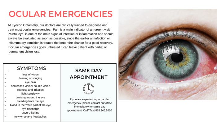 Emergency emergencies urgent Urgent care eye doctor