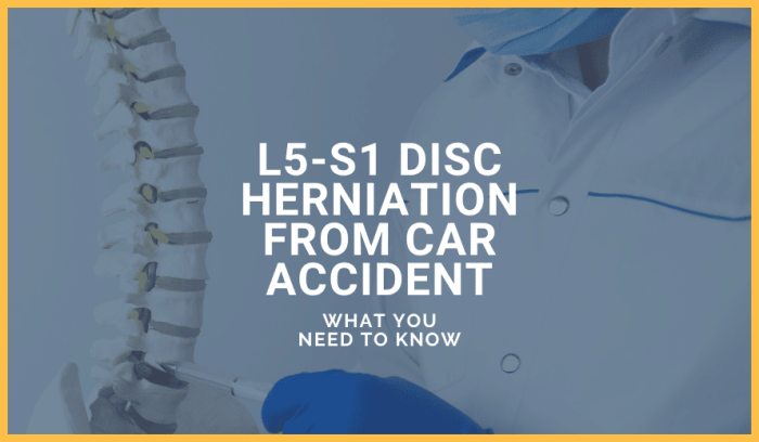 Can a car accident cause sciatica