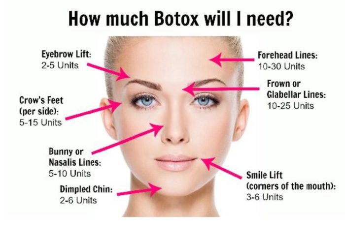 How much botox do i need