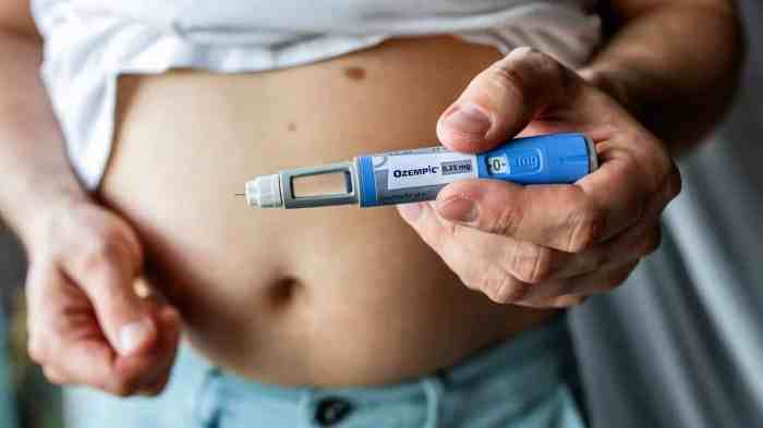 Allintitle:how to get prescribed ozempic for weight loss