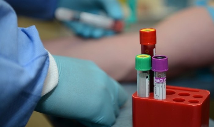 How quickly will doctor call with blood test results